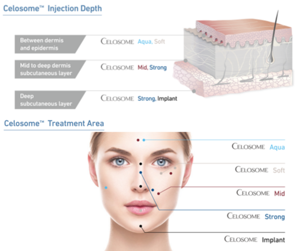 Celosome Strong | Korean Fillers