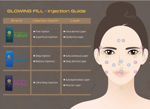 Glowing Fill Dermal Filler Injection Guide